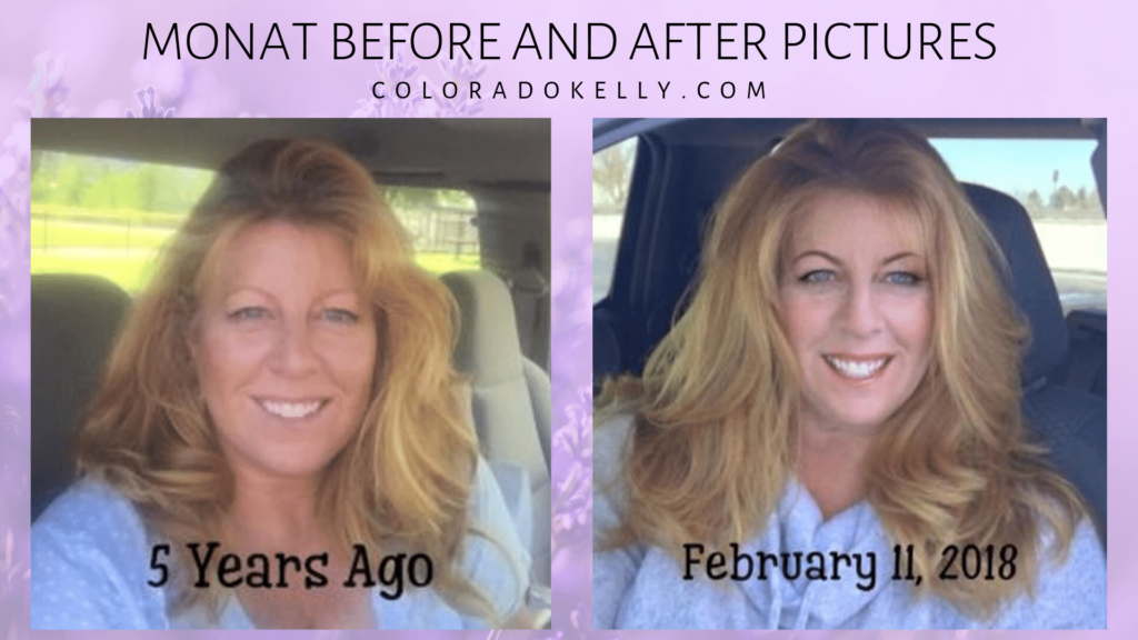 Monat before and after pictures